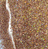 Laser Desert Gold Glitter HOLOgraphic-Design Blanks